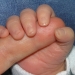 Chliini Fingerli